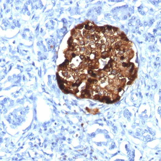 Chromogranin A / CHGA (Neuroendocrine Marker); Clone CHGA/1815R (Concentrate)