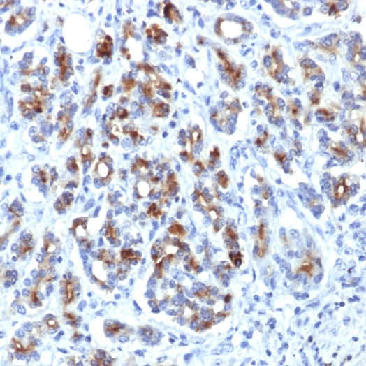 Alpha-1-Antichymotrypsin (SERPINA3) (Histiocytoma Marker); Clone AACT/1451 (Concentrate)