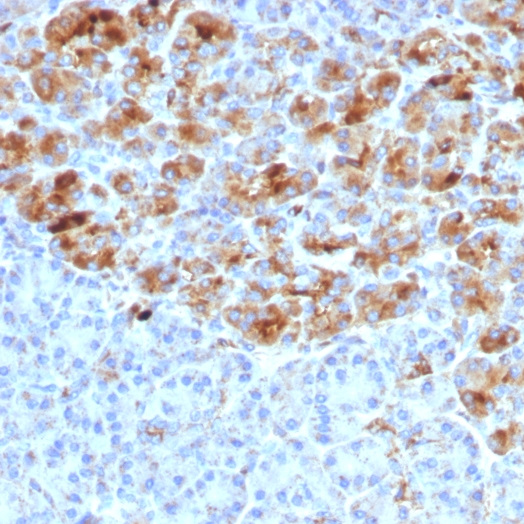 Alpha-1-Antichymotrypsin (SERPINA3) (Histiocytoma Marker); Clone AACT/1452 (Concentrate)