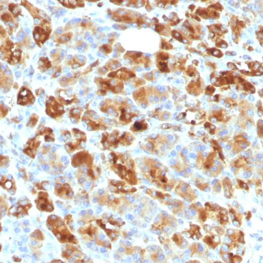 Alpha-1-Antichymotrypsin (SERPINA3) (Histiocytoma Marker); Clone AACT/1451 & AACT/1452 (Concentrate)