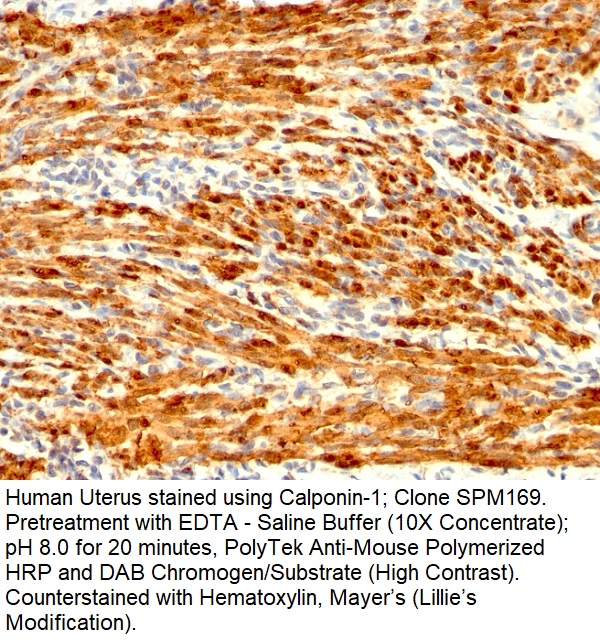 Calponin-1 (Smooth Muscle Marker); Clone SPM169 (Concentrate)