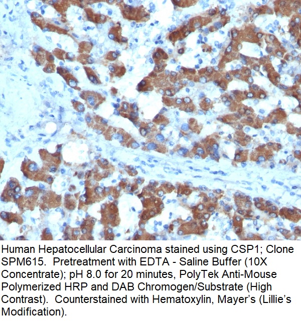 CPS1 / Carbamoyl-Phosphate Synthetase (Hepatocellular Marker); Clone SPM615 (Concentrate)
