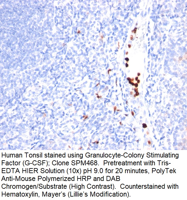 Granulocyte-Colony Stimulating Factor (G-CSF); Clone SPM468 (Concentrate)