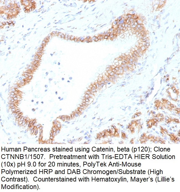 Catenin, beta (p120); Clone CTNNB1/1507 (Concentrate)