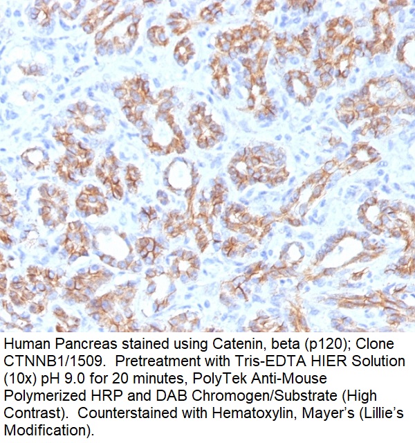 Catenin, beta (p120); Clone CTNNB1/1509 (Concentrate)
