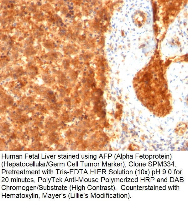 AFP (Alpha Fetoprotein) (Hepatocellular/Germ Cell Tumor Marker); Clone SPM334 (Concentrate)
