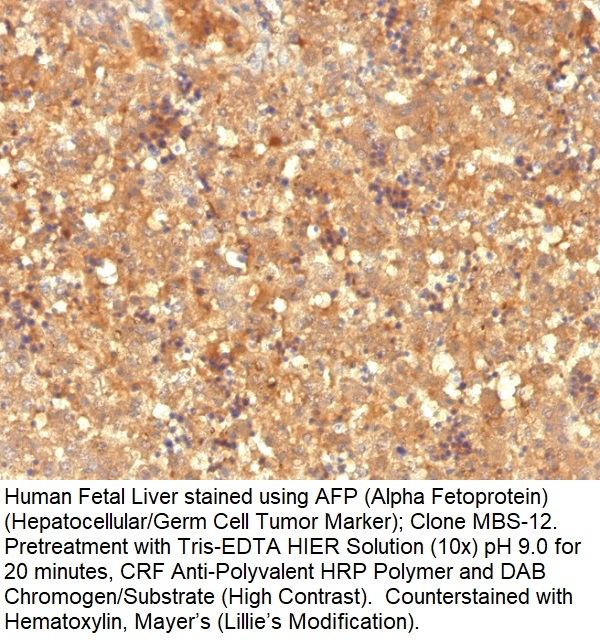 AFP (Alpha Fetoprotein) (Hepatocellular/Germ Cell Tumor Marker); Clone MBS-12 (Concentrate)