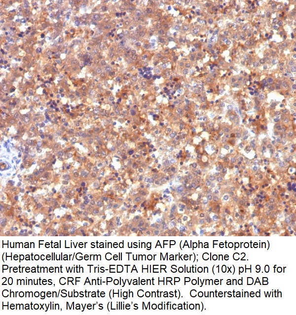 AFP (Alpha Fetoprotein) (Hepatocellular/Germ Cell Tumor Marker); Clone C2 (Concentrate)