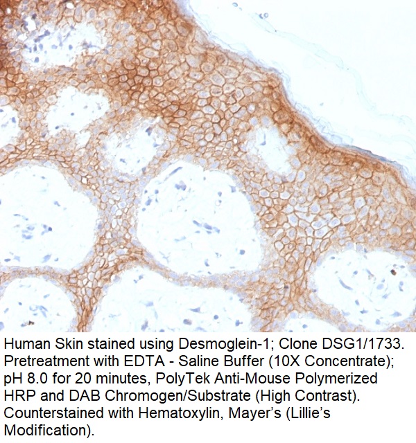 Desmoglein-1 (DSG1); Clone DSG1/1733 (Concentrate)