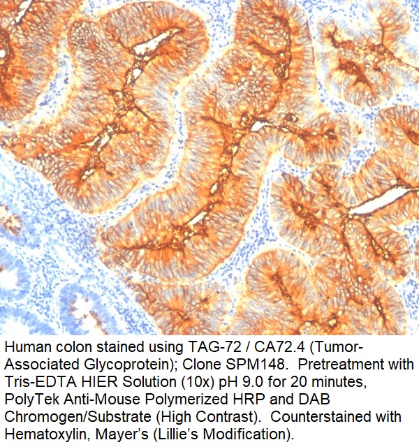 TAG-72 / CA72.4 (Tumor-Associated Glycoprotein); Clone SPM148 (Concentrate)