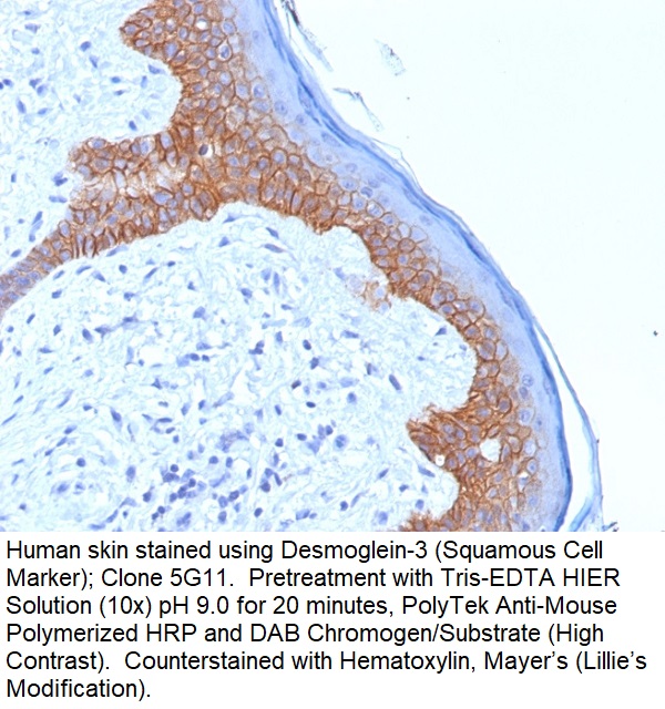 Desmoglein-3 (Squamous Cell Marker); Clone 5G11 (Concentrate)