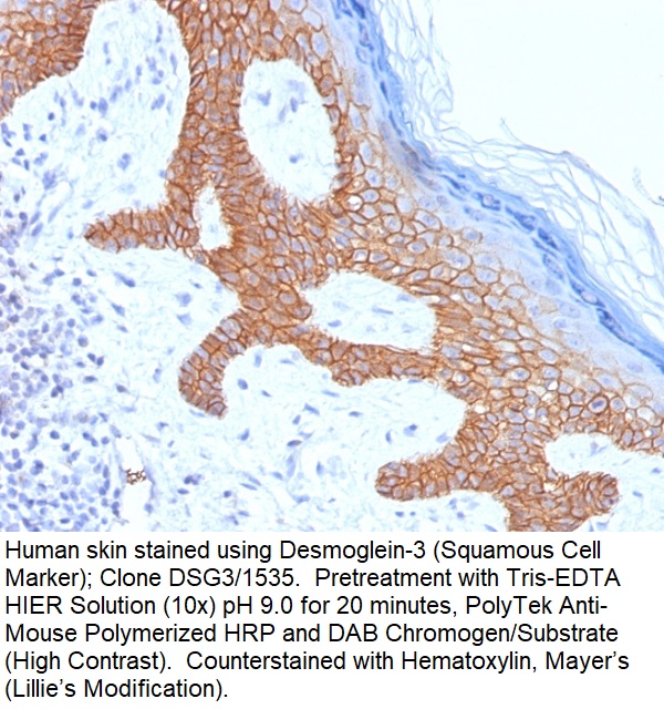 Desmoglein-3 (Squamous Cell Marker); Clone DSG3/1535 (Concentrate)