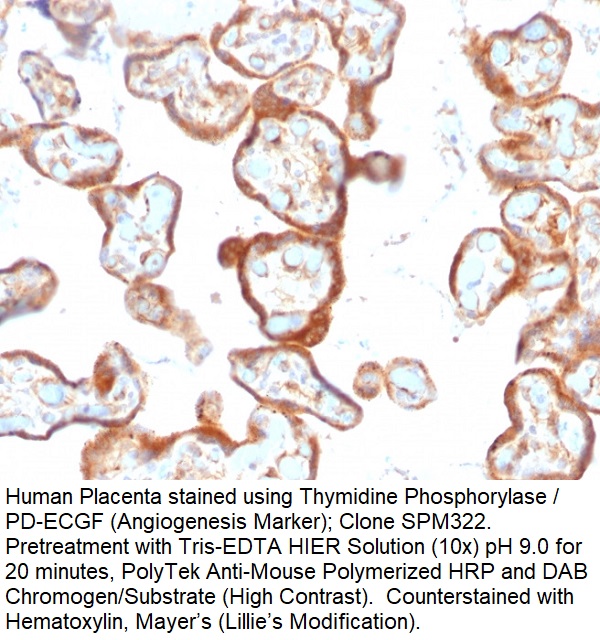 Thymidine Phosphorylase / PD-ECGF (Angiogenesis Marker); Clone SPM322 (Concentrate)