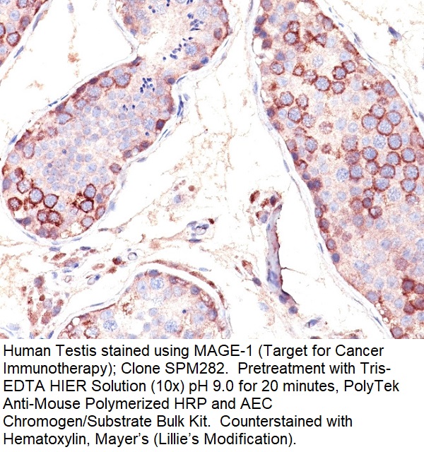 MAGE-1 (Target for Cancer Immunotherapy); Clone SPM282 (Concentrate)