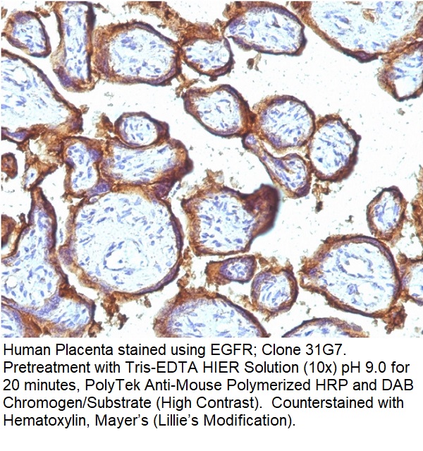 EGFR (Epidermal Growth Factor Receptor); Clone 31G7 (Concentrate)