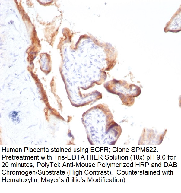 EGFR (Epidermal Growth Factor Receptor); Clone SPM622 (Concentrate)