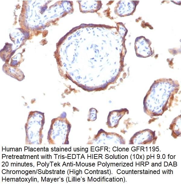 EGFR (Epidermal Growth Factor Receptor); Clone GFR1195 (Concentrate)