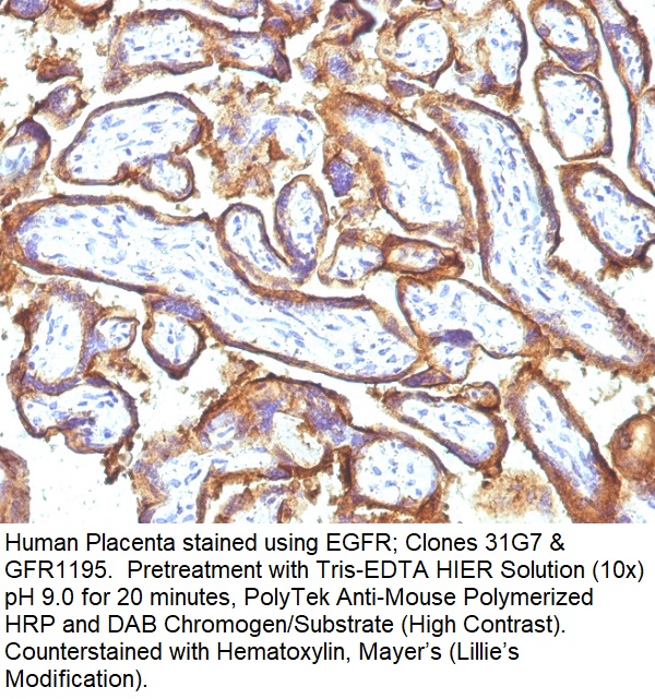 EGFR (Epidermal Growth Factor Receptor); Clone 31G7 + GFR1195 (Concentrate)