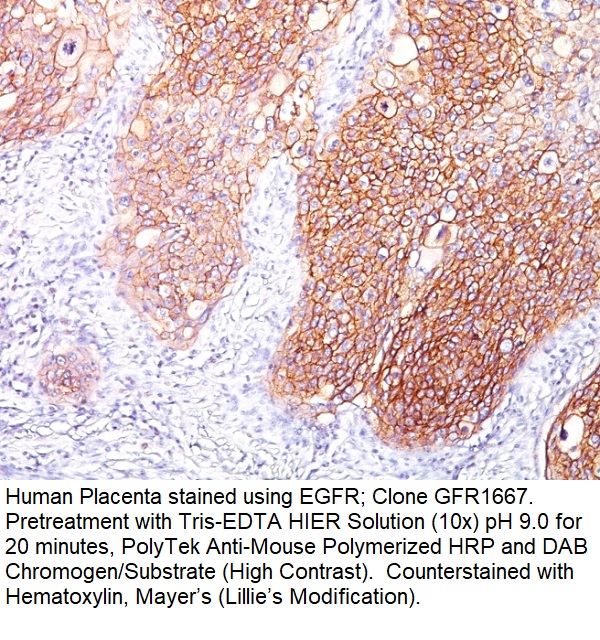 EGFR (Epidermal Growth Factor Receptor); Clone GFR/1667 (Concentrate)