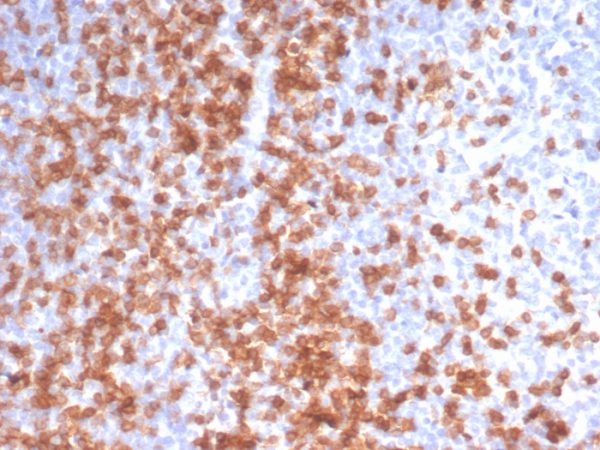 Recombinant CD3e (T-Cell Marker); Clone C3e/3125R