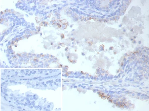 ABCC4 / ATP Binding Cassette Subfamily C Member 4 (Drug Target); Clone ABCC4/9018