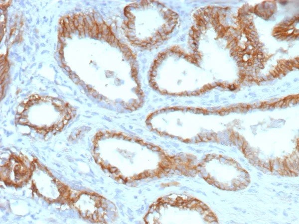 ABCC4 / ATP Binding Cassette Subfamily C Member 4 (Drug Target); Clone ABCC4/9178