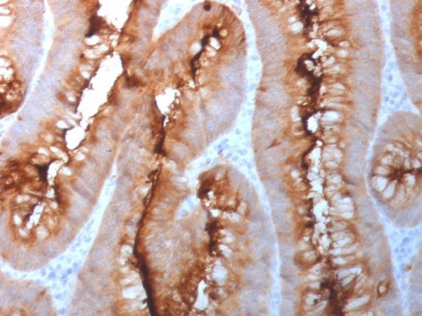 Carcinoembryonic Antigen (CEA) / CD66; Clone N/A