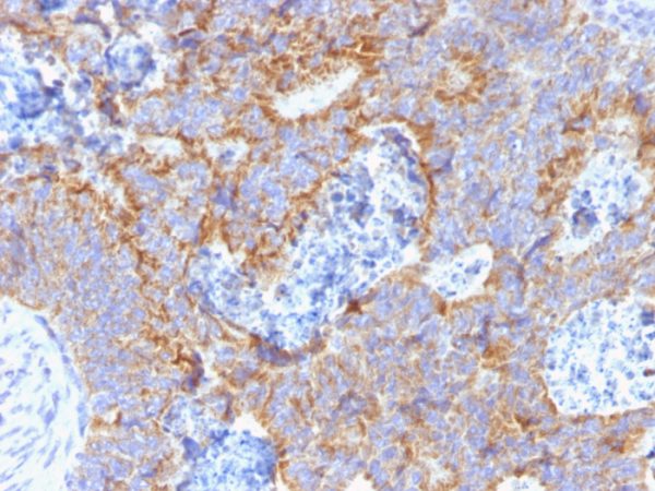 Carcinoembryonic Antigen (CEA) / CD66; Clone C66/1291