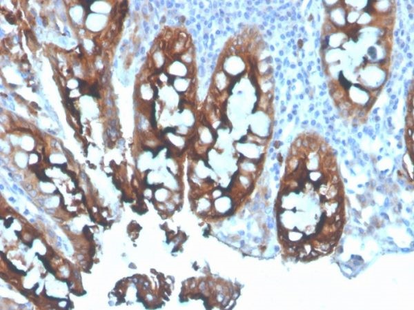 Carcinoembryonic Antigen (CEA) / CD66; Rabbit Polyclonal (Concentrate)