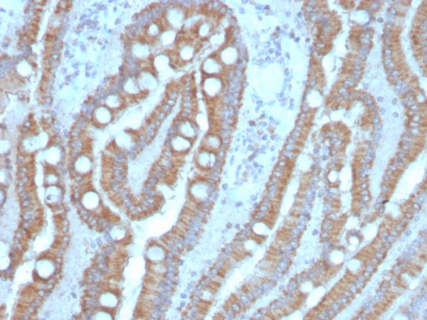 Carcinoembryonic Antigen (CEA) / CD66e; Clone C66/4098