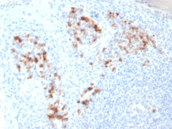 CD138 / Syndecan-1 (SDC1) (Plasma Cell Marker); Clone SDC1/7182