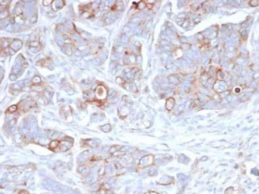 CD138 / Syndecan-1 (SDC1) (Plasma Cell Marker); Clone SDC1/7178