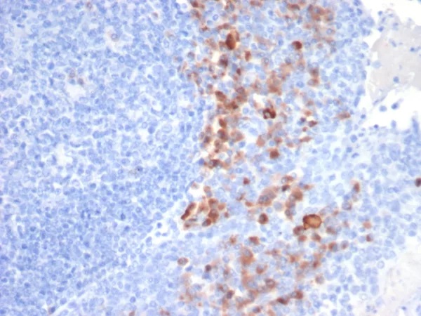 CD138 / Syndecan-1 (SDC1) (Plasma Cell Marker); Clone SDC1/7183