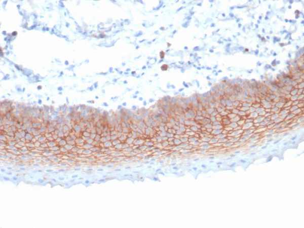CD138 / Syndecan-1 (SDC1) (Plasma Cell Marker); Clone SDC1/7180