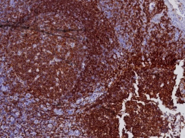 CD19 (B-Lymphocyte Marker); Clone CD19/7665