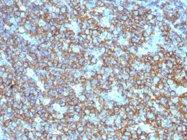 CD20 / MS4A1 (B-Cell Marker); Polyclonal