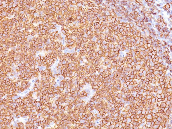 CD20 / MS4A1 (B-Cell Marker); Clone SPM618