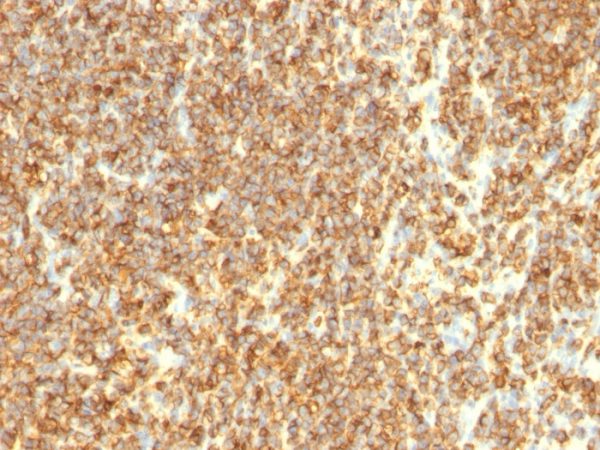 CD20 / MS4A1 (B-Cell Marker); Clone SPM494