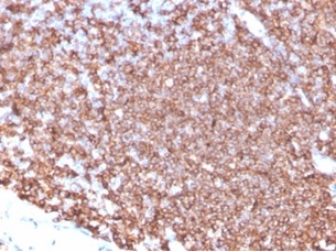 CD20 / MS4A1 (B-Cell Marker); Clone MS4A1/4655