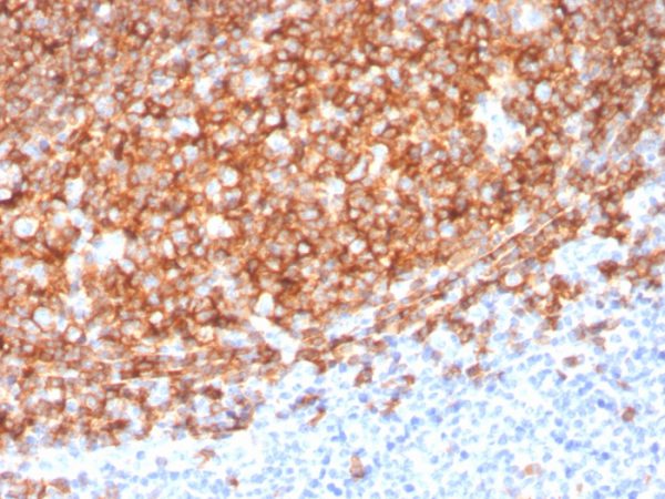 CD20 / MS4A1 (B-Cell Marker); Clone MS4A1/3410