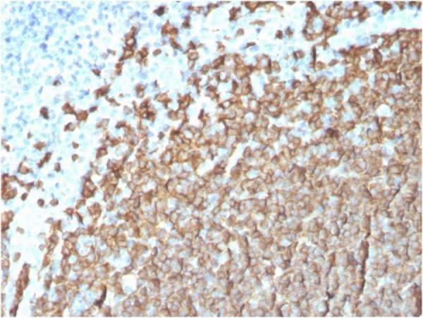 CD20 / MS4A1 (B-Cell Marker); Clone MS4A1/3411