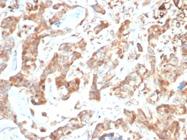 CD269 / TNFRSF17 / BCMA (B-Cell Maturation Protein); Clone BCMA/7254