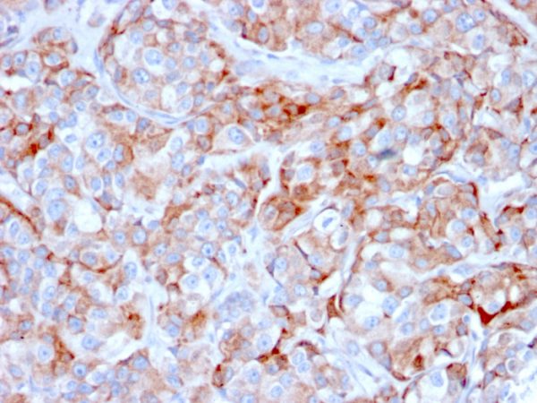CD269 / TNFRSF17 / BCMA (B-Cell Maturation Protein); Clone BCMA/2366