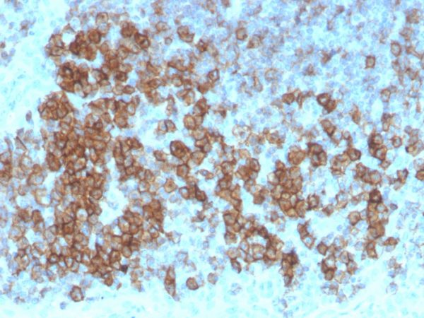 CD27 (Tumor Necrosis Factor Receptor Superfamily 7); Clone LPFS2/4179