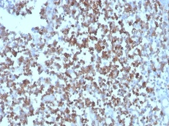CD27 (Tumor Necrosis Factor Receptor Superfamily 7); Clone LPFS2/4178