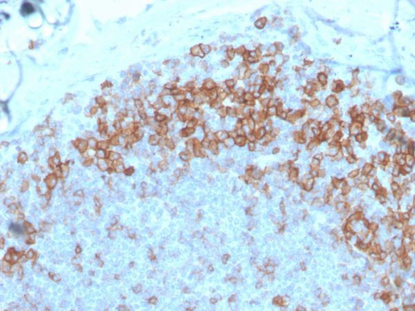 CD27 (Tumor Necrosis Factor Receptor Superfamily 7); Clone LPFS2/4177