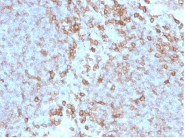 CD27 (Tumor Necrosis Factor Receptor Superfamily 7); Clone LPFS2/4176