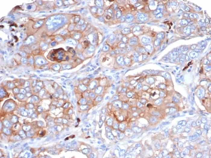 CD276 / B7-H3; Clone B7H3/4479