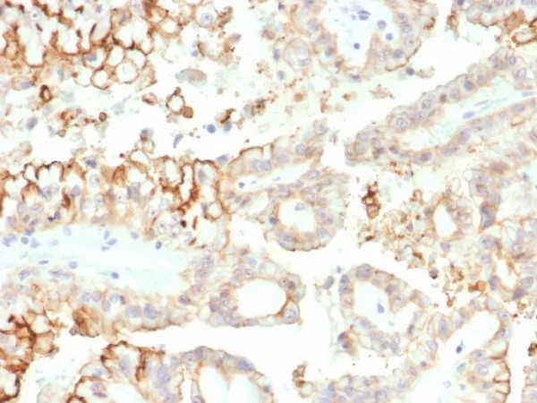 CD276 / B7-H3; Clone B7H3/ 4313