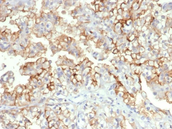 CD276 / B7-H3; Clone B7H3/4312
